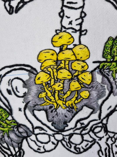 Patient 46, Adult Female, Age 38 - Detail 2