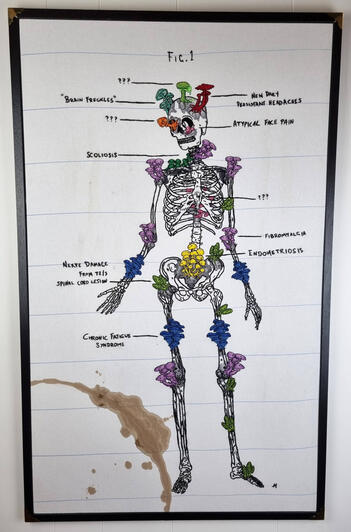 Patient 46, Adult Female, Age 38